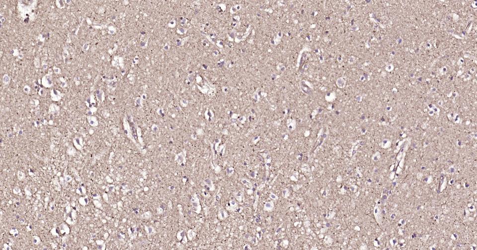微管蛋白β1重组兔单抗-bsm-61710R