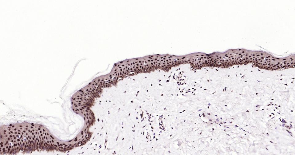 少突胶质细胞转录因子3重组兔单抗-bsm-62456R