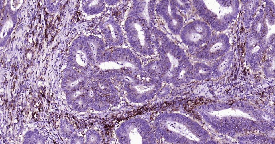 CD44抗体重组兔单抗-bsm-63050R