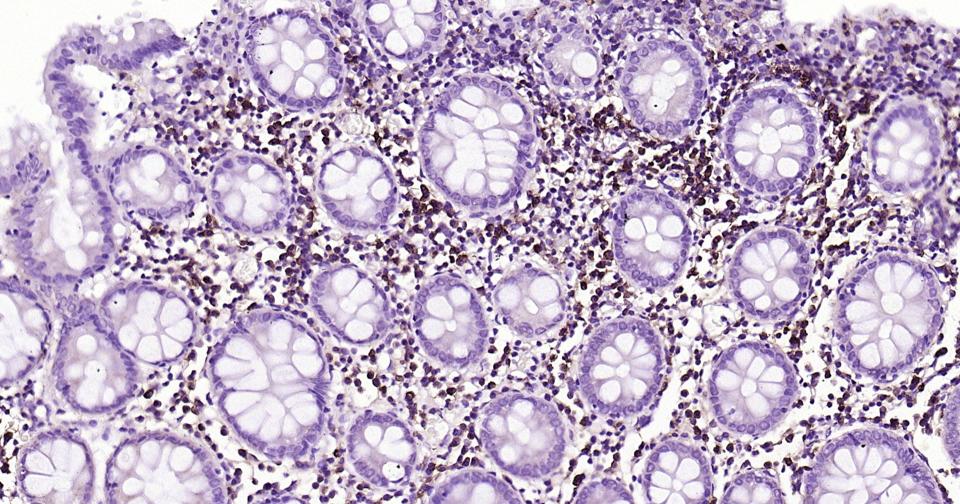 CD44抗体重组兔单抗-bsm-63050R