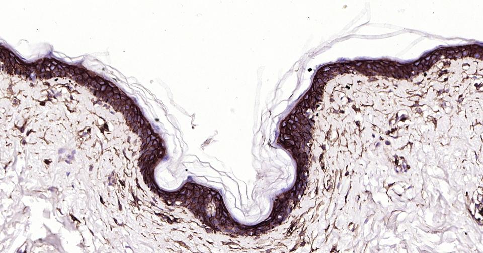 CD44抗体重组兔单抗-bsm-63050R