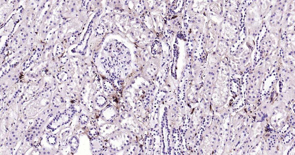 CD44抗体重组兔单抗-bsm-63050R