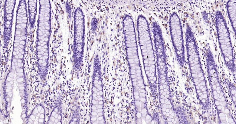 CD33重组兔单抗-bsm-60920R
