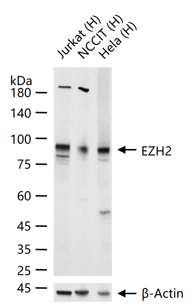 抑癌蛋白EZH2重组兔单抗-bsm-63051R
