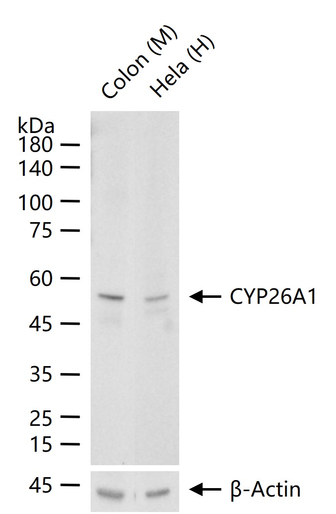 细胞色素cP450 CYP26A1重组兔单抗-bsm-54341R