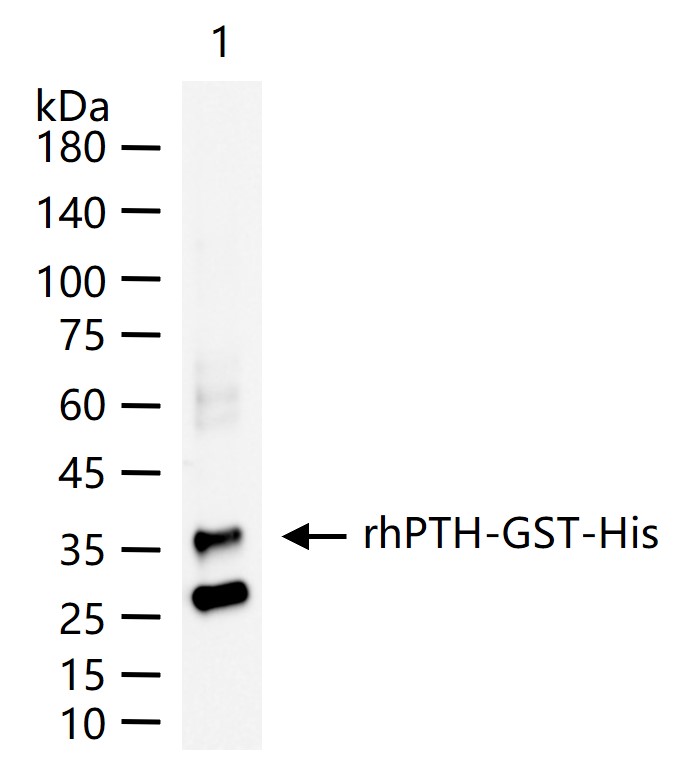 甲状旁腺激素重组兔单抗-bsm-61590R