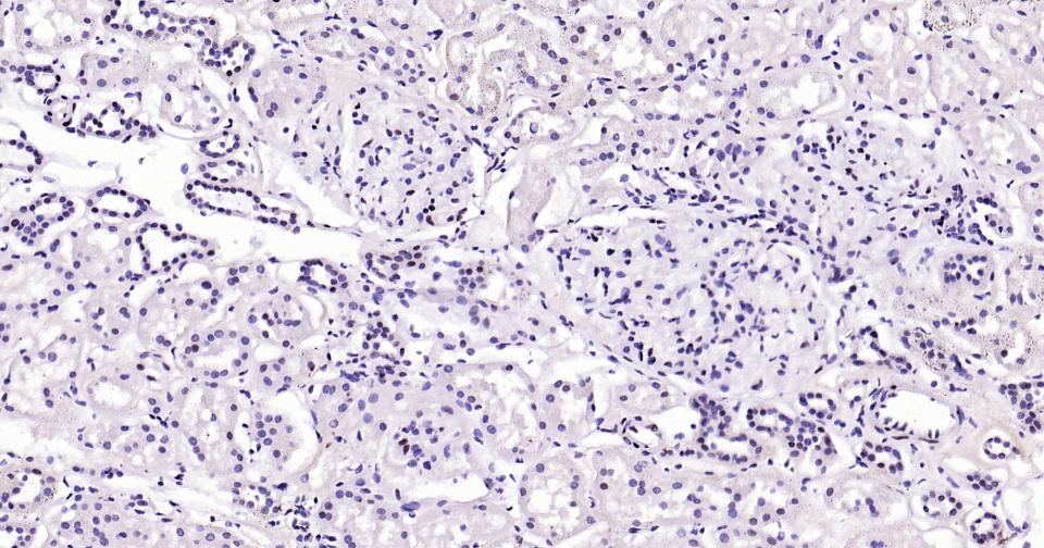 磷酸化信号转导和转录激活因子3重组兔单抗-bsm-52210R