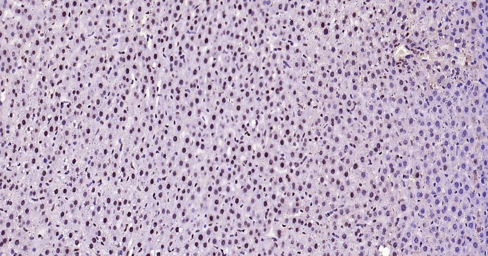 磷酸化信号转导和转录激活因子3重组兔单抗-bsm-52210R