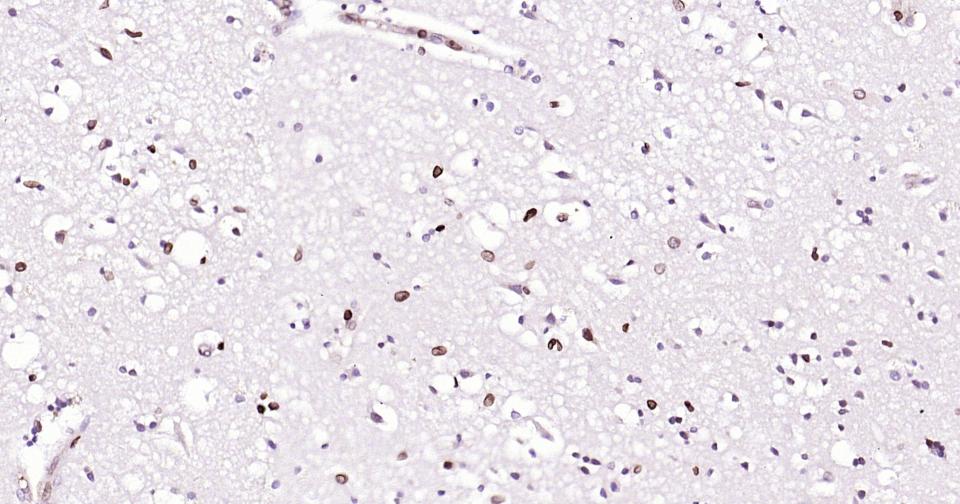 核纤层蛋白B重组兔单抗-bsm-52361R