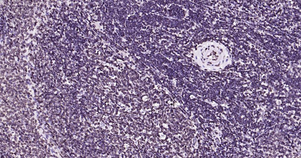 核纤层蛋白B重组兔单抗-bsm-52361R