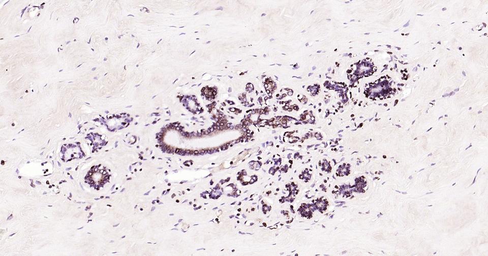 核纤层蛋白B重组兔单抗-bsm-52361R
