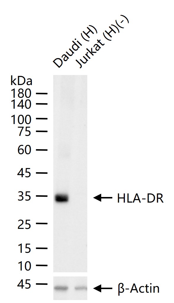 HLA-DR重组兔单抗-bsm-52535R
