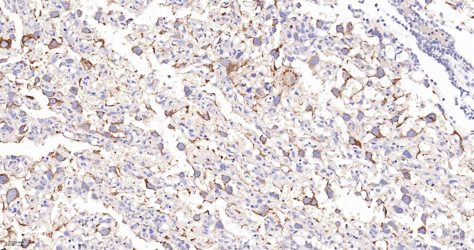 溶酶体相关膜蛋白2（CD107B）重组兔单抗-bsm-61207R