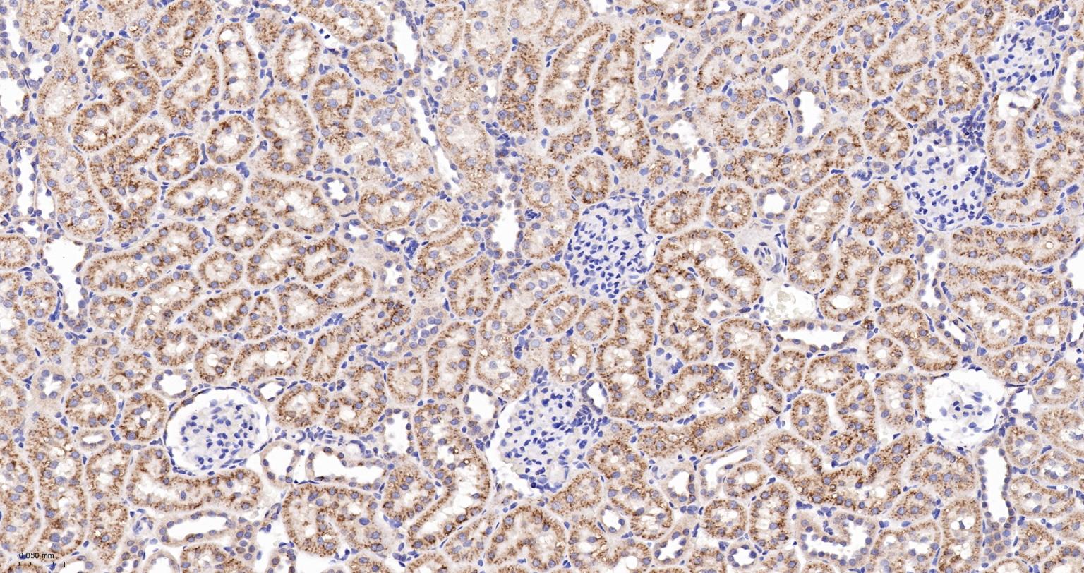 溶酶体相关膜蛋白2（CD107B）重组兔单抗-bsm-61207R
