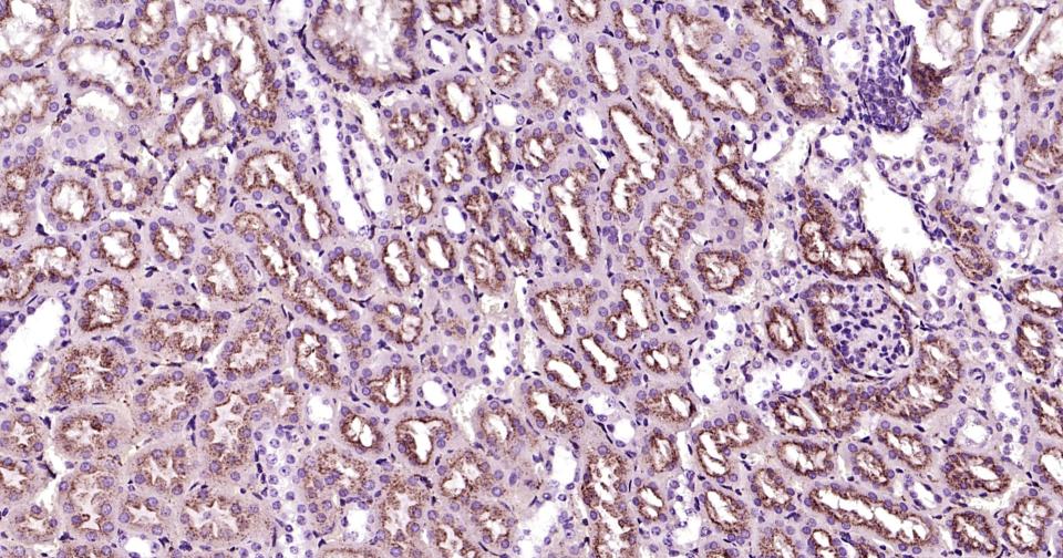 溶酶体相关膜蛋白2（CD107B）重组兔单抗-bsm-61207R