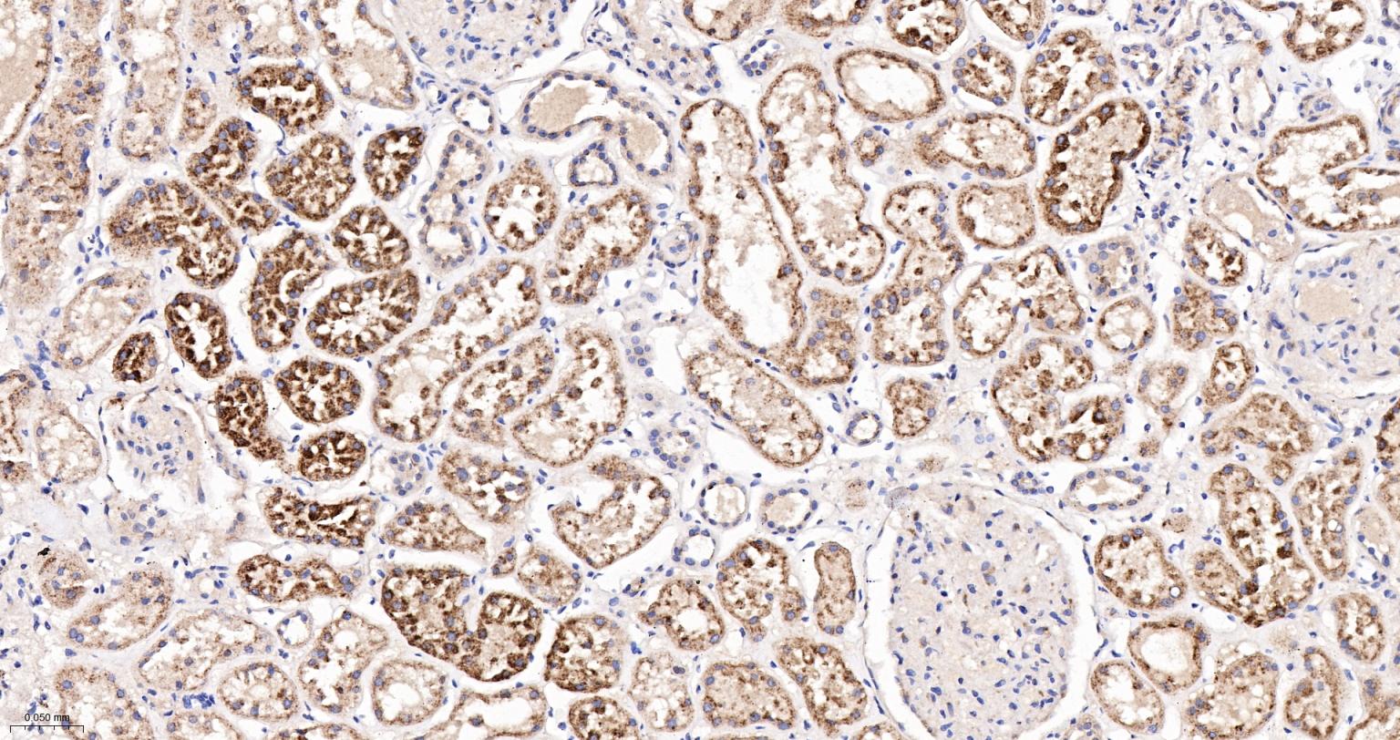 溶酶体相关膜蛋白2（CD107B）重组兔单抗-bsm-61207R