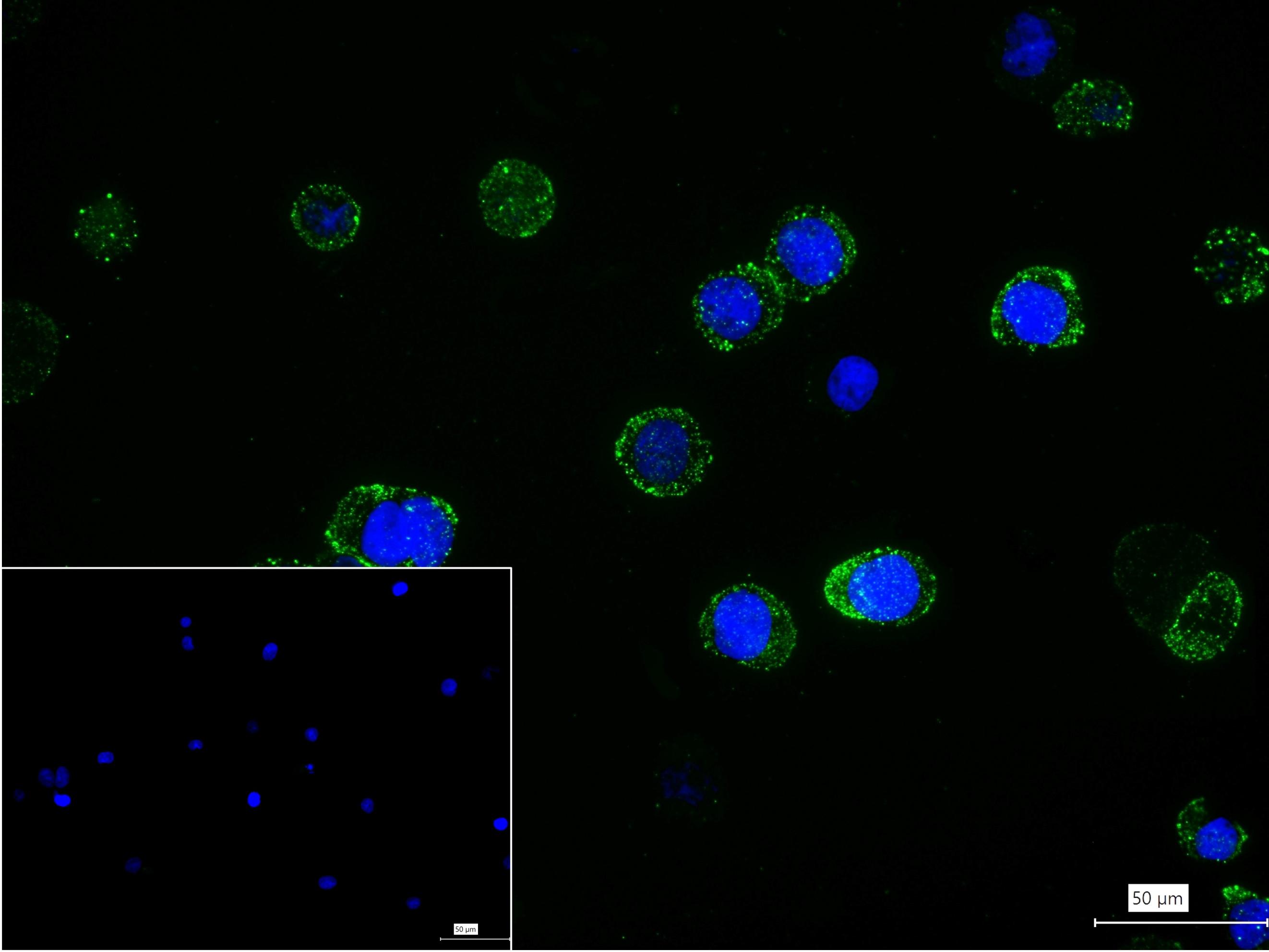 CD10重组兔单抗-bsm-62909R