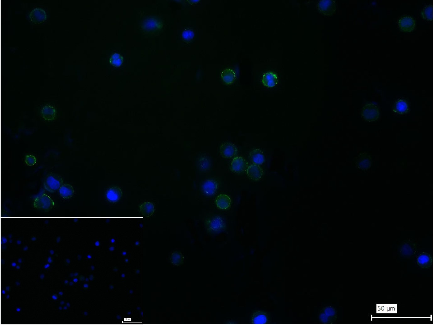 诱导协同刺激分子CD278重组兔单抗-bsm-60227R