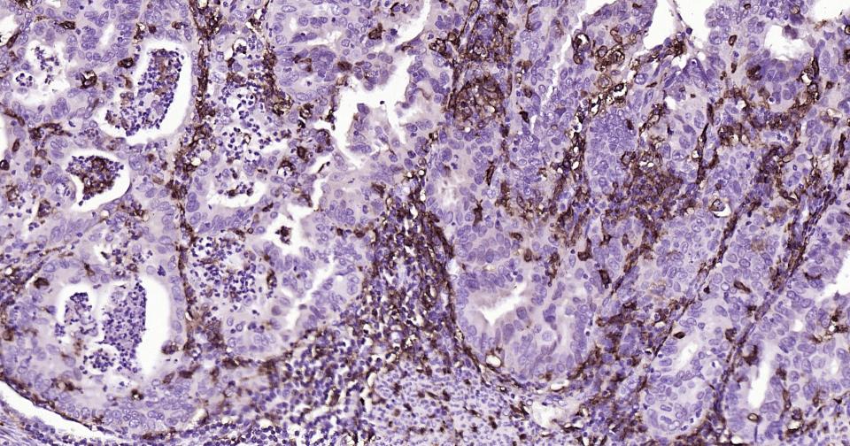 CD14重组兔单抗-bsm-52556R