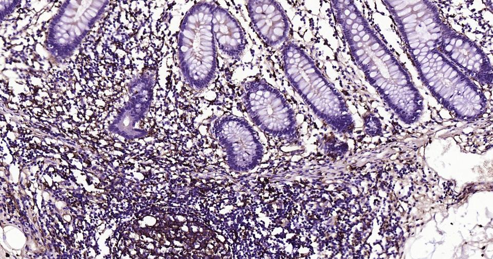CD14重组兔单抗-bsm-52556R