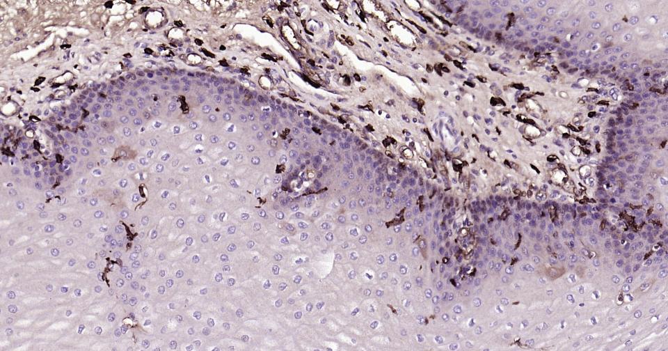 CD14重组兔单抗-bsm-52556R
