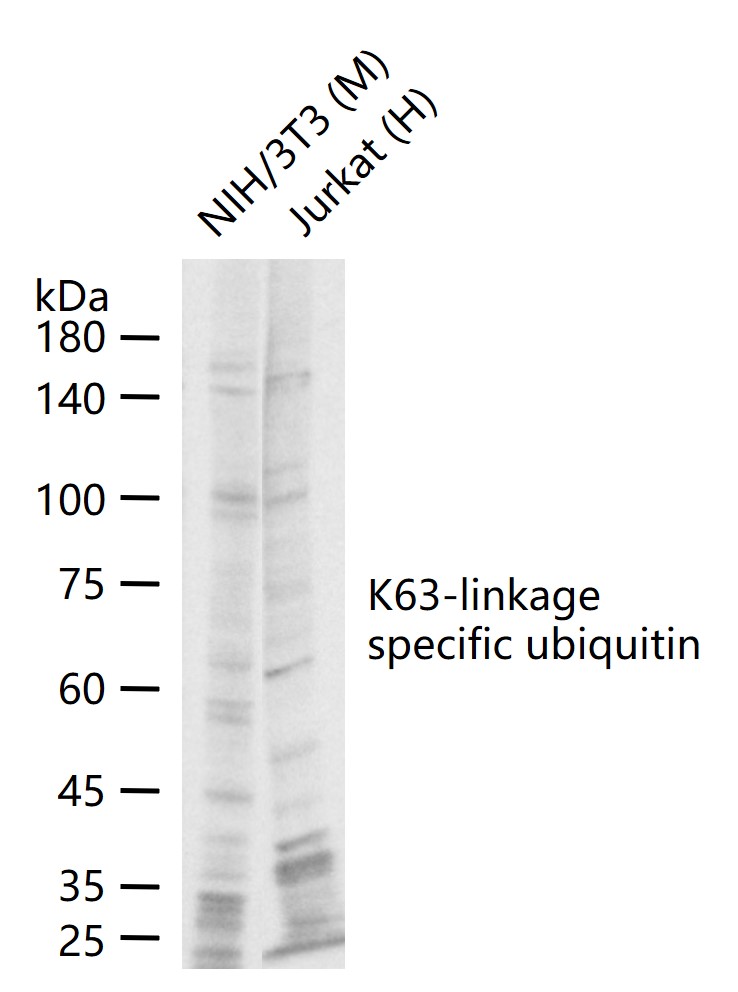 泛素蛋白（K63-linkage）重组兔单抗-bsm-63006R