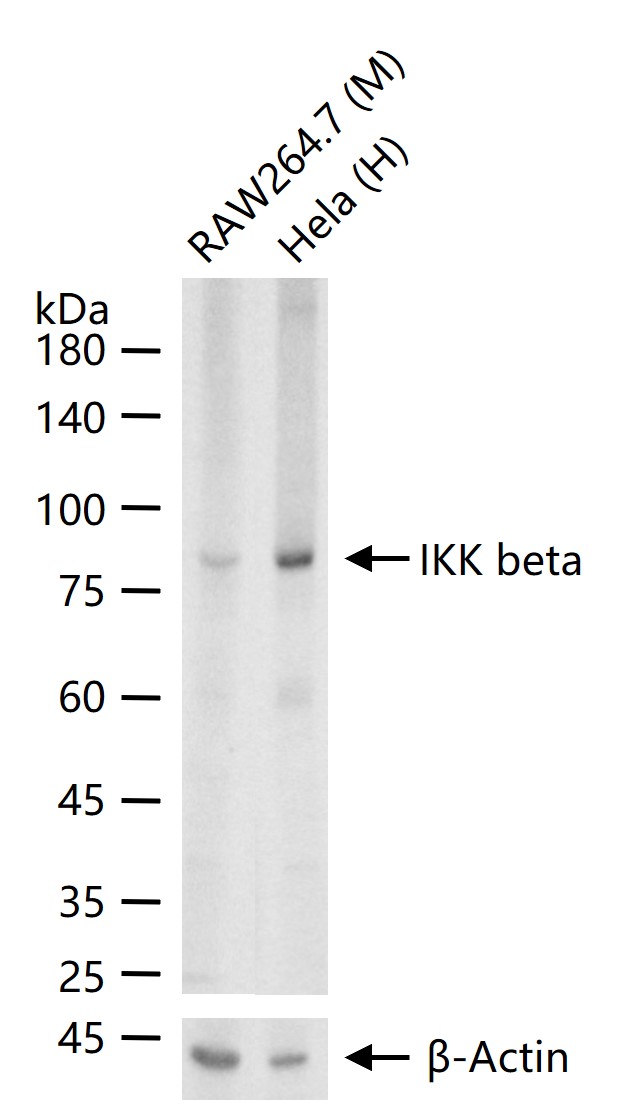 KB抑制蛋白激酶β重组兔单抗-bsm-62794R