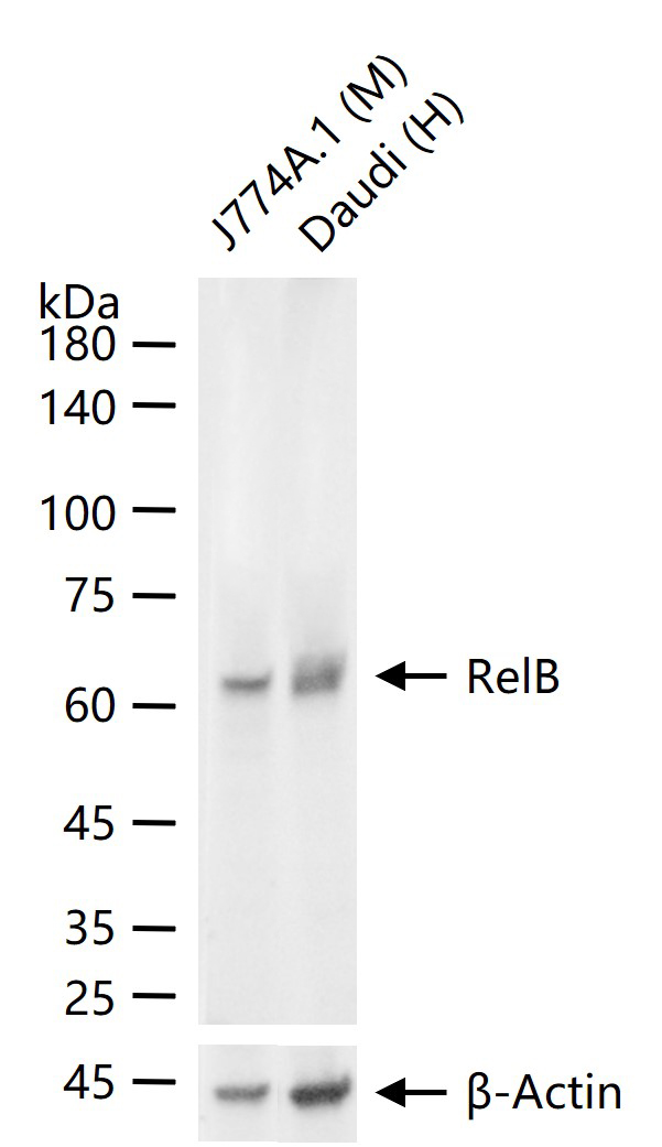 转录因子RelB蛋白重组兔单抗-bsm-62968R