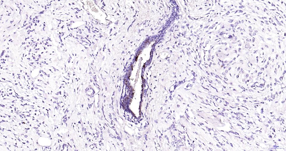 乳铁蛋白重组兔单抗-bsm-62892R