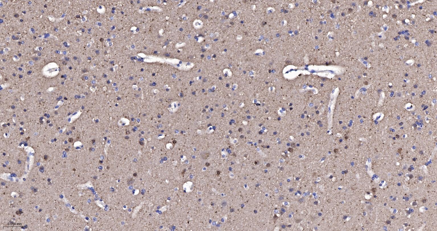 神经细胞胞浆蛋白9.5重组兔单抗-bsm-41257R