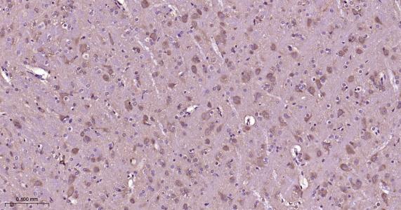 p21激活激酶1重组兔单抗-bsm-62929R