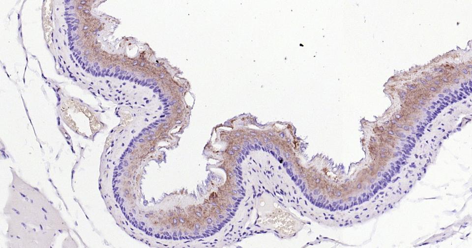 Rho相关蛋白激酶1重组兔单抗-bsm-62969R