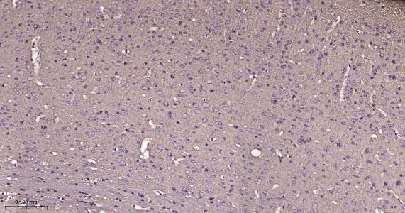 微管蛋白β1 tubulin(内参)重组兔单抗-bsm-33041R