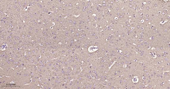 微管蛋白β1 tubulin(内参)重组兔单抗-bsm-33041R