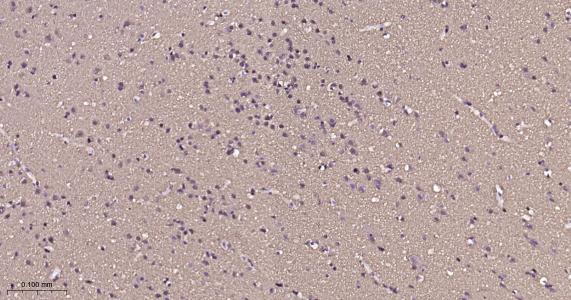 微管蛋白β1 tubulin(内参)重组兔单抗-bsm-33041R
