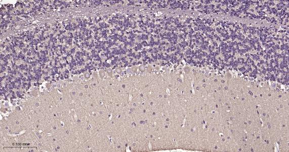 微管蛋白β1 tubulin(内参)重组兔单抗-bsm-33041R
