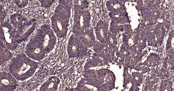 微管蛋白β1 tubulin(内参)重组兔单抗-bsm-33041R
