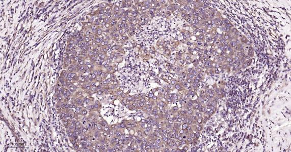 微管蛋白β1 tubulin(内参)重组兔单抗-bsm-33041R