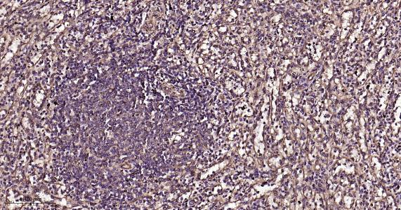 微管蛋白β1 tubulin(内参)重组兔单抗-bsm-33041R