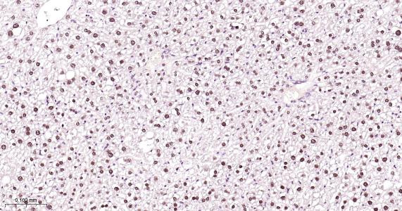 肝细胞核因子4α重组兔单抗-bsm-62576R