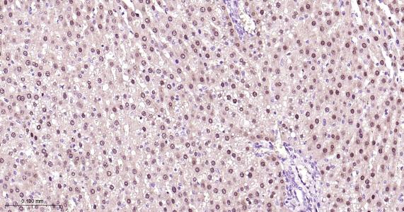 肝细胞核因子4α重组兔单抗-bsm-62576R