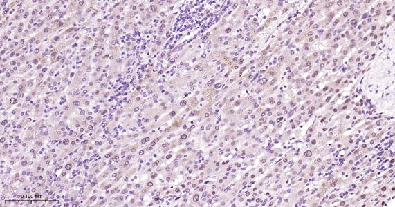 肝细胞核因子4α重组兔单抗-bsm-62576R