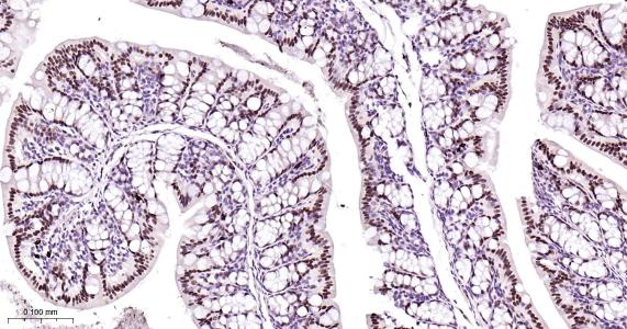 肝细胞核因子4α重组兔单抗-bsm-62576R