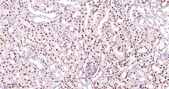 肝细胞核因子4α重组兔单抗-bsm-62576R