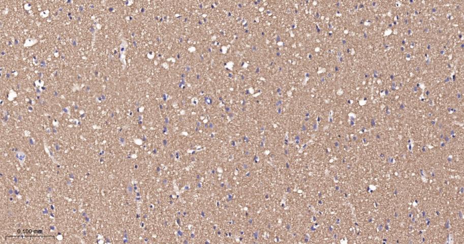 肾上腺素能受体β2重组兔单抗-bsm-52880R