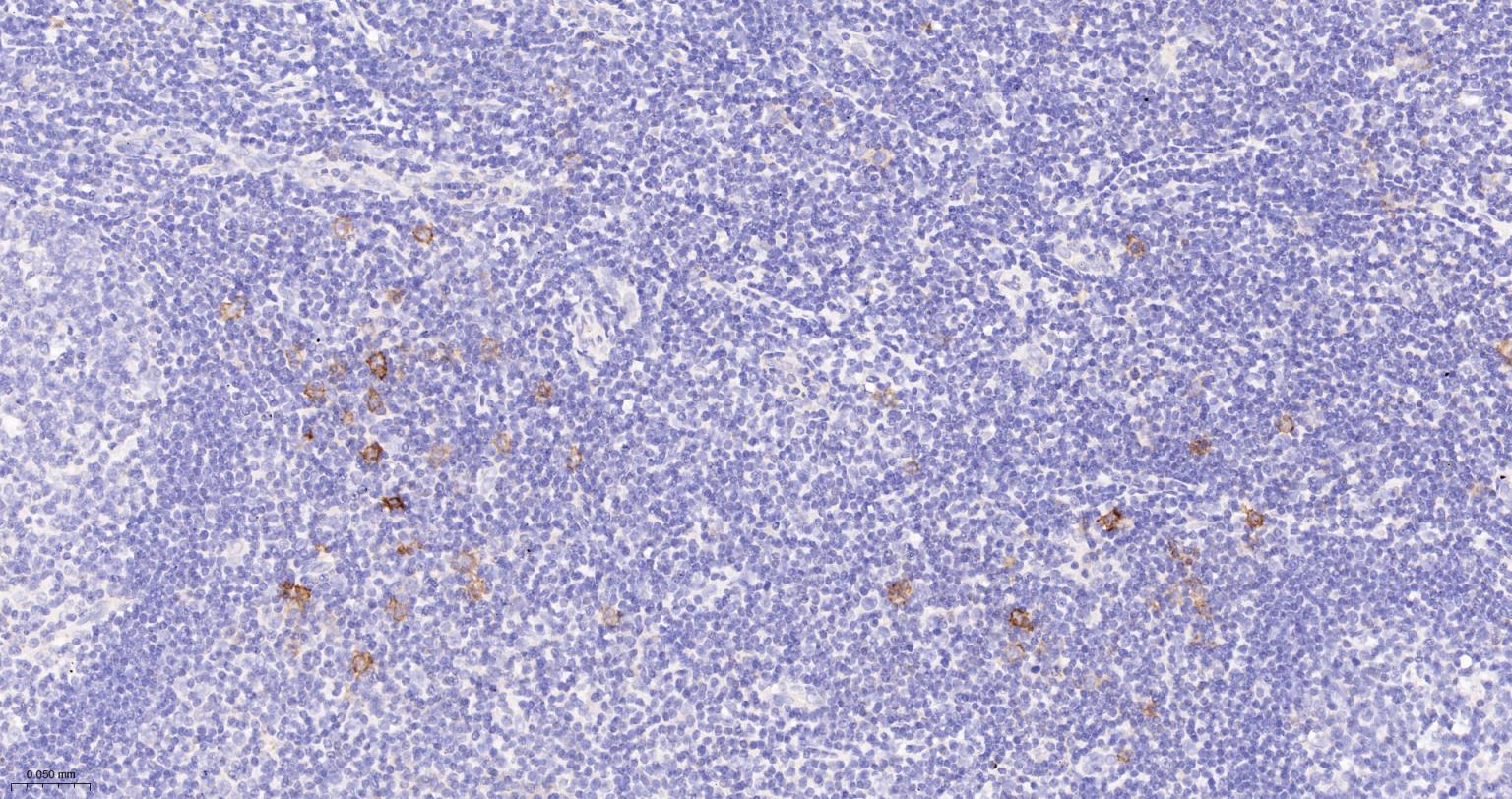 CD30重组兔单抗-bsm-54798R