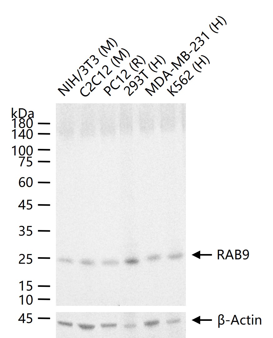 ras癌基因家族Rab9蛋白重组兔单抗-bsm-61205R