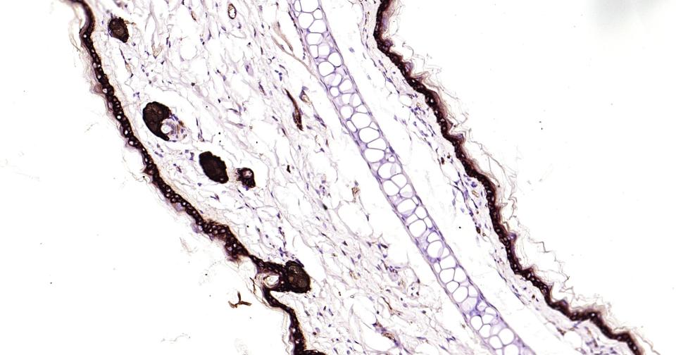 细胞角蛋白14重组兔单抗-bsm-52054R