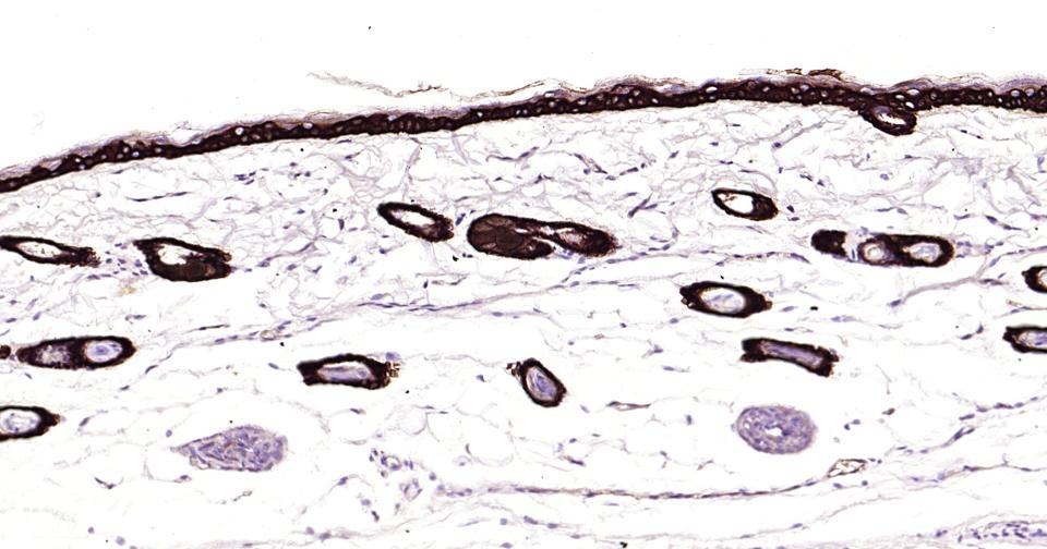 细胞角蛋白14重组兔单抗-bsm-52054R