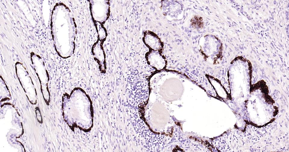 细胞角蛋白14重组兔单抗-bsm-52054R